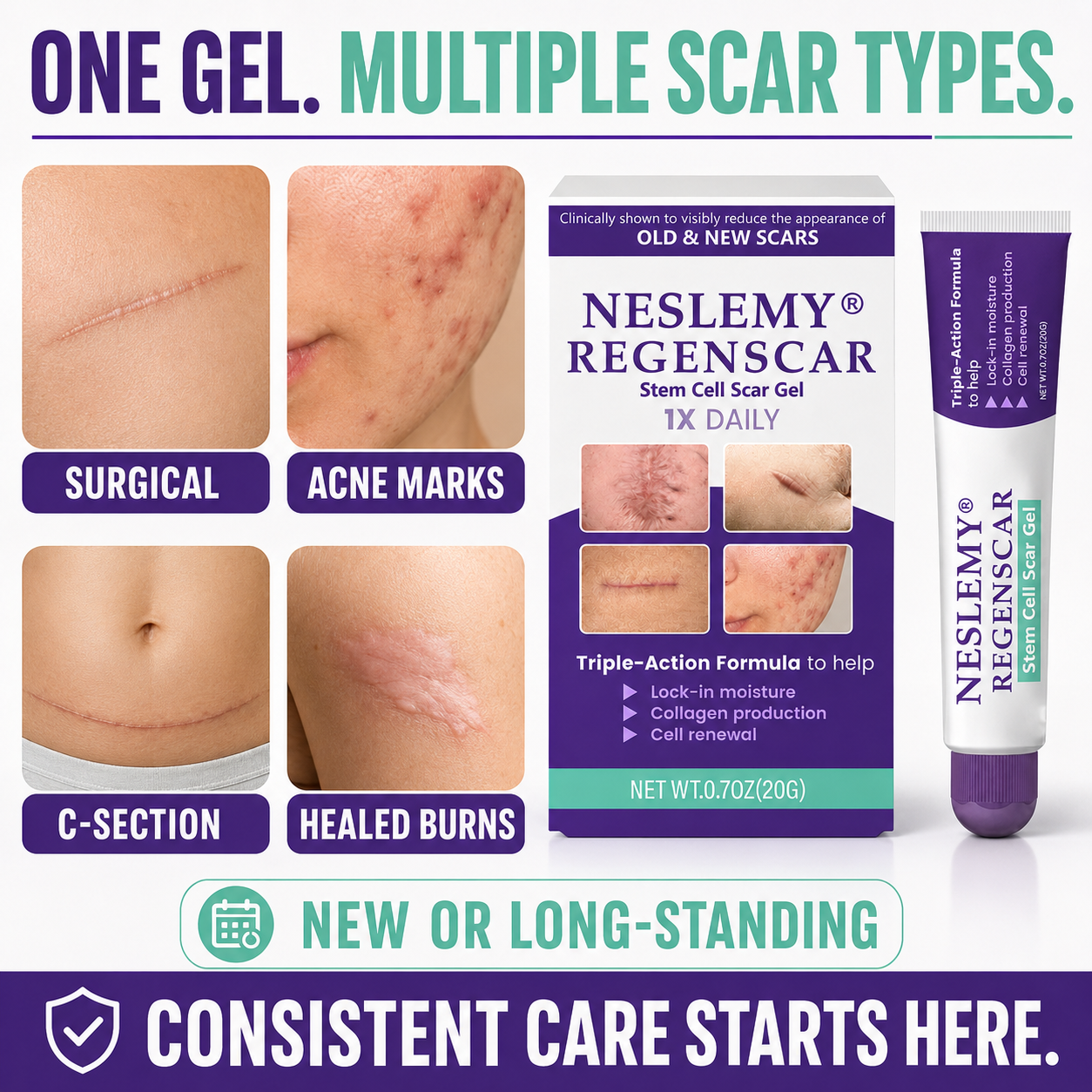 🌟 BUY 1 GET 1 FREE-NESLEMY® Scar Gel ✨ Refresh Your Skin Today!