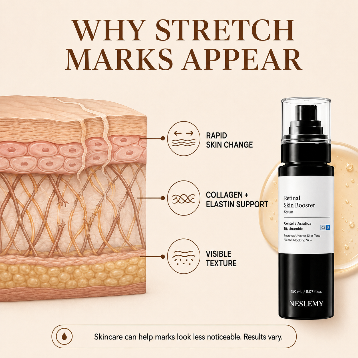 💥70K+ SOLD💕NESLEMY® Advanced Retinal Stretch Mark Serum — Pregnancy, Growth & Weight-Change Care
