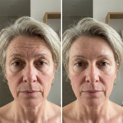 🔥LAST DAY Buy 1 Get 1 Free🔥- Line Smoother Perfect Skin in 3 Minutes