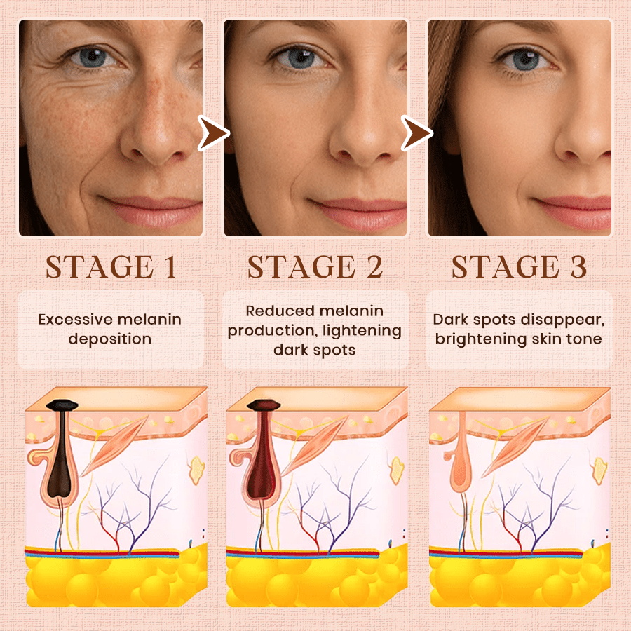 Cougex® Purifying Exfoliating Gel for Acanthosis Nigricans, Exfoliation, Dark Spots, Skin Tags, and Eczema 🎁
