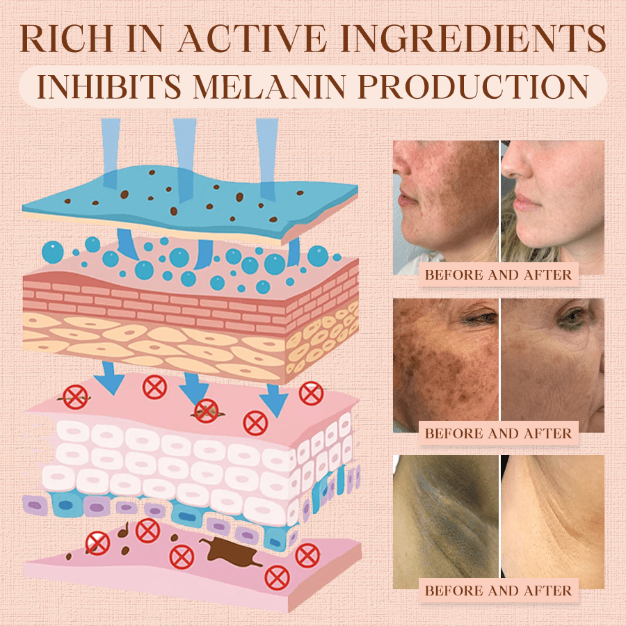 Cougex® Purifying Exfoliating Gel for Acanthosis Nigricans, Exfoliation, Dark Spots, Skin Tags, and Eczema 🎁