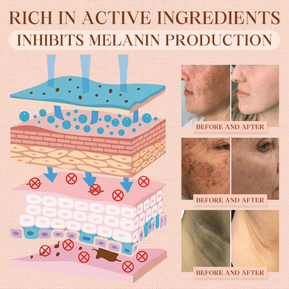 Cougex® Purifying Exfoliating Gel for Acanthosis Nigricans, Exfoliation, Dark Spots, Skin Tags, and Eczema 🎁