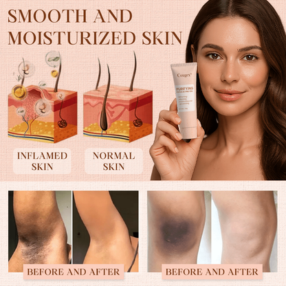 Cougex® Purifying Exfoliating Gel for Acanthosis Nigricans, Exfoliation, Dark Spots, Skin Tags, and Eczema 🎁