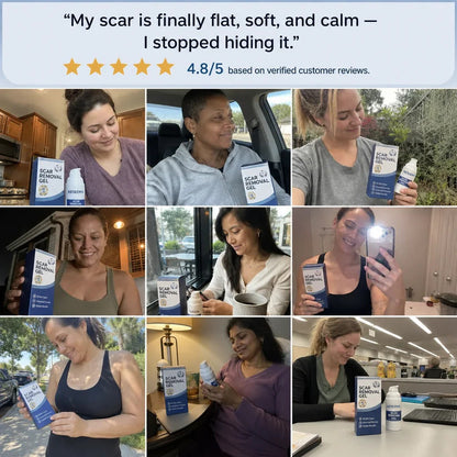 Buy 1 Get 1 Free🔥NESLEMY Scar Removel Gel Smoothing Skin Hydrate & Moisturize