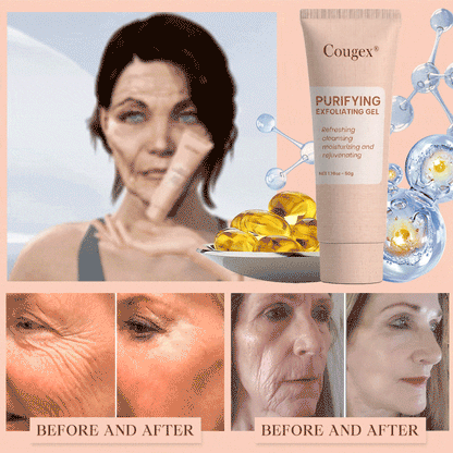 Cougex® Purifying Exfoliating Gel for Acanthosis Nigricans, Exfoliation, Dark Spots, Skin Tags, and Eczema 🎁