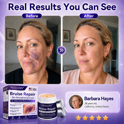 💥100K+ SOLD💕-NESLEMY® Bruise Repair & Skin-Strengthening Cream
