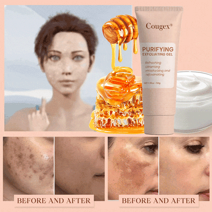 Cougex® Purifying Exfoliating Gel for Acanthosis Nigricans, Exfoliation, Dark Spots, Skin Tags, and Eczema 🎁