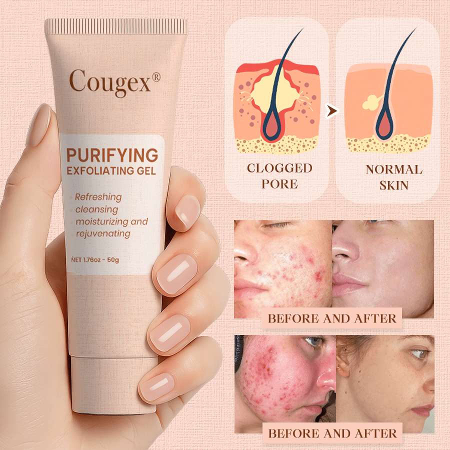 Cougex® Purifying Exfoliating Gel for Acanthosis Nigricans, Exfoliation, Dark Spots, Skin Tags, and Eczema 🎁