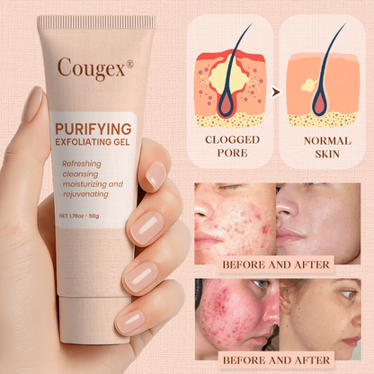 Cougex® Purifying Exfoliating Gel for Acanthosis Nigricans, Exfoliation, Dark Spots, Skin Tags, and Eczema 🎁