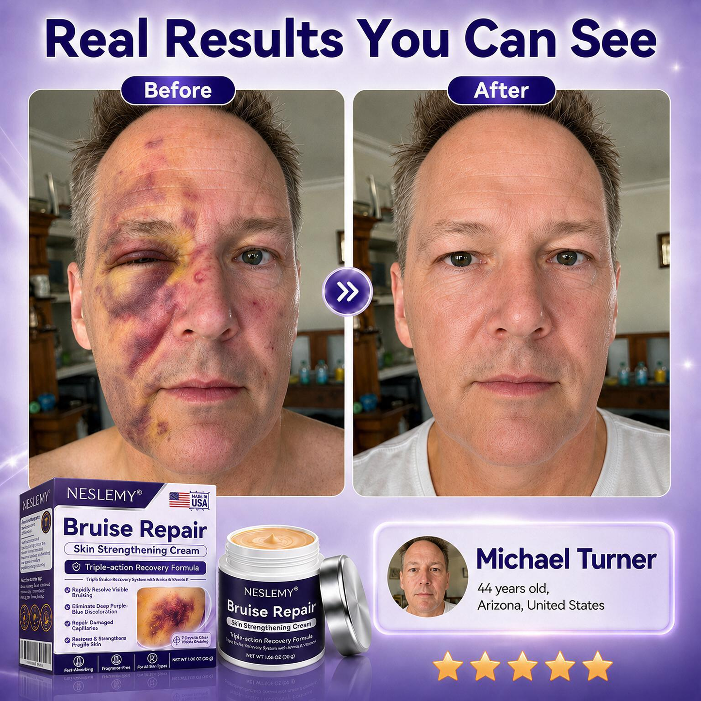 💥100K+ SOLD💕-NESLEMY® Bruise Repair & Skin-Strengthening Cream