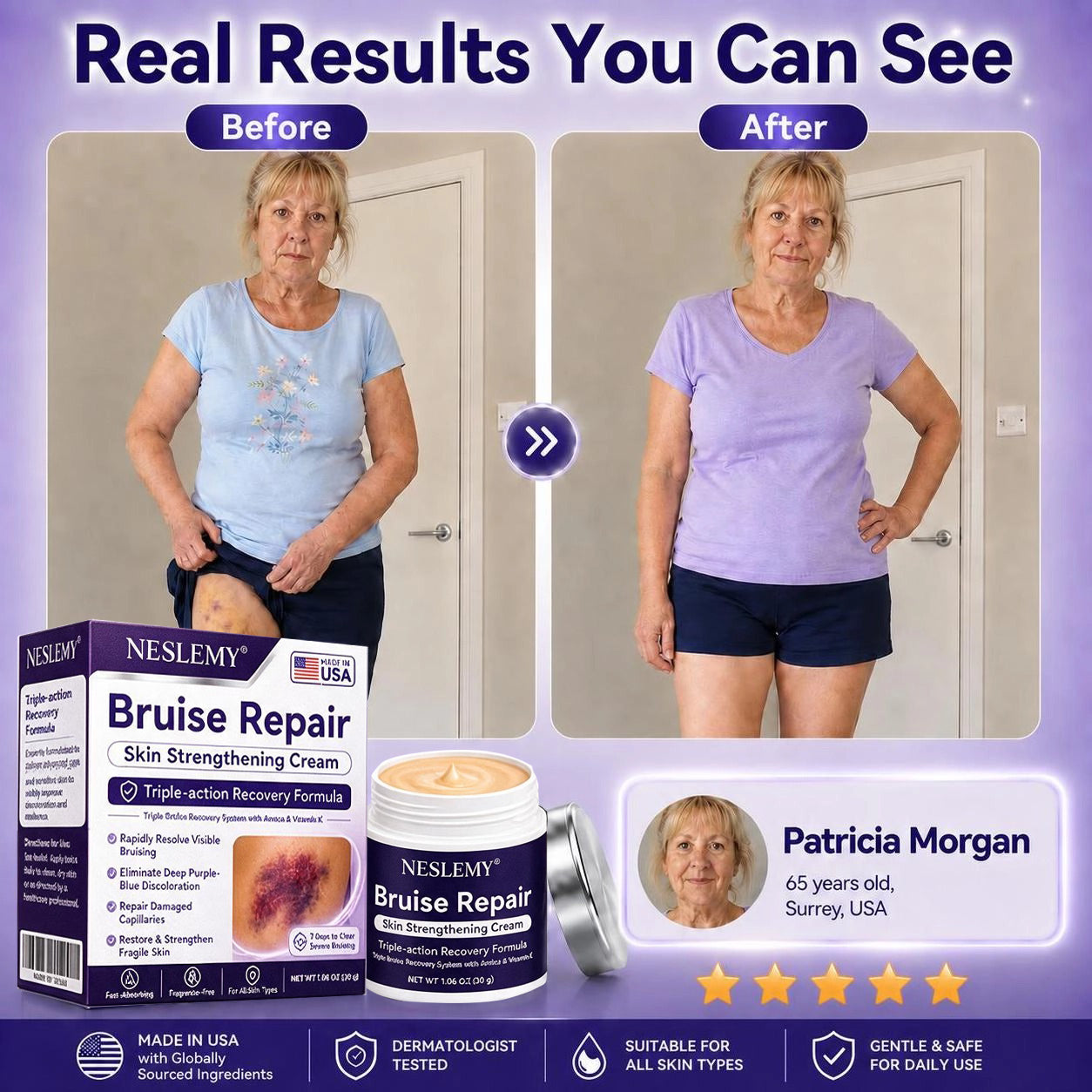 💥100K+ SOLD💕-NESLEMY® Bruise Repair & Skin-Strengthening Cream