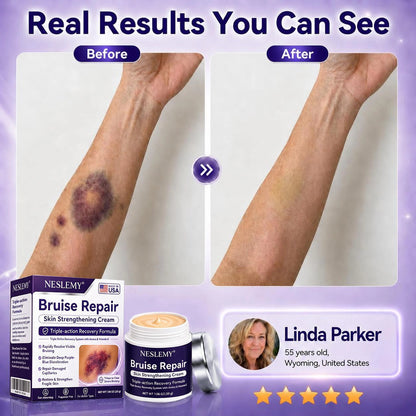 💥100K+ SOLD💕-NESLEMY® Bruise Repair & Skin-Strengthening Cream