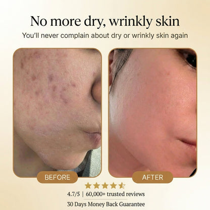 Organic Tallow Honey Balm to Help Erase Fine Lines, Wrinkles, and Age Spots