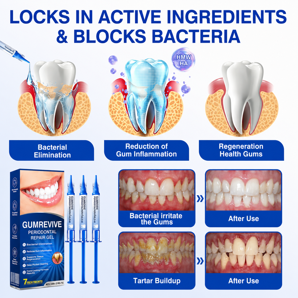 Buy 1 Get 1 Free🦷Periodontal Repair Gel