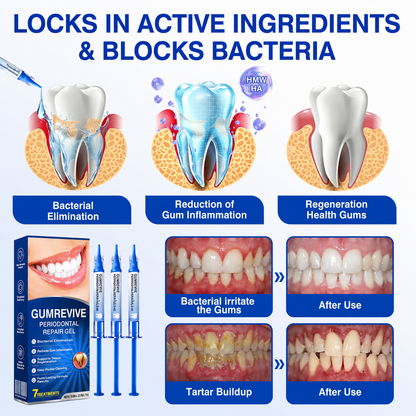 Buy 1 Get 1 Free🦷Periodontal Repair Gel
