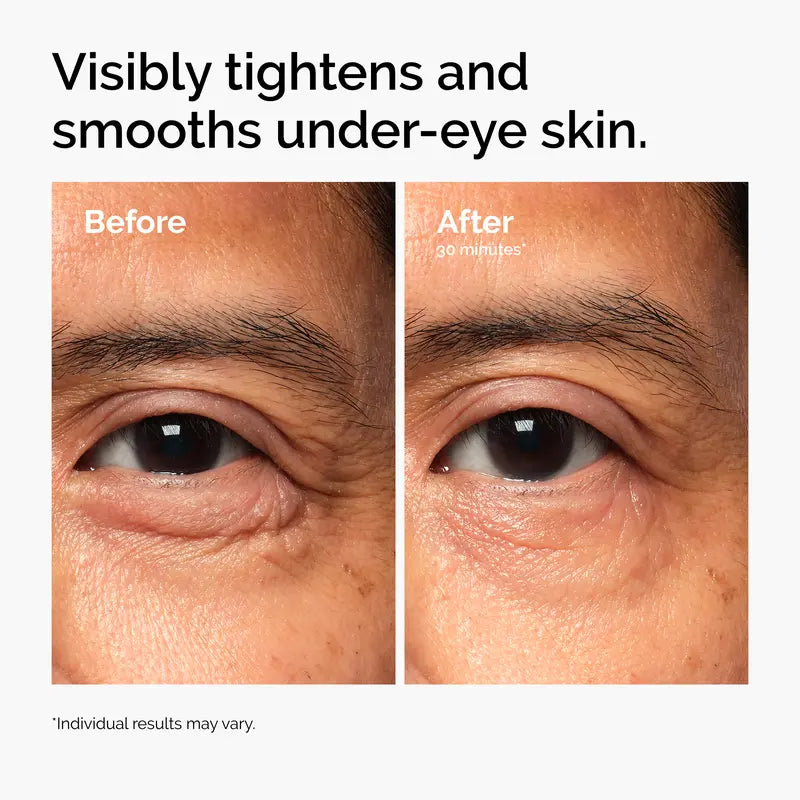 🔥LAST DAY Buy 1 Get 1 Free🔥Lacto-PDRN* 4% + B9 Eye Cream