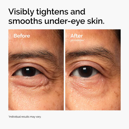🔥LAST DAY Buy 1 Get 1 Free🔥Lacto-PDRN* 4% + B9 Eye Cream