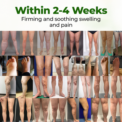 🔥 BUY 1 GET 1 FREE Professional Leg Circulation Cream – Soothe Swelling & Heavy Legs 🦵