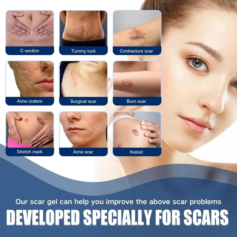 Buy 1 Get 1 Free🔥NESLEMY Scar Removel Gel Smoothing Skin Hydrate & Moisturize