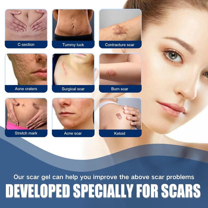 Buy 1 Get 1 Free🔥NESLEMY Scar Removel Gel Smoothing Skin Hydrate & Moisturize
