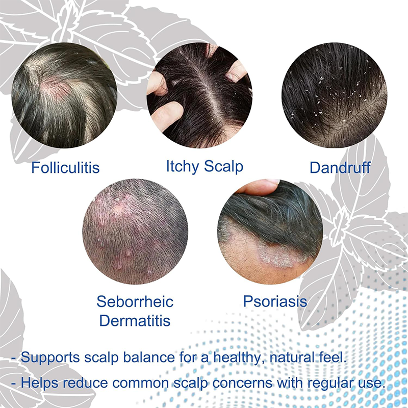 ✨BUY 1 GET 1 FREE✨ NESLEMY  Folliculitis Shampoo for Itchy, Flaky & Oily Scalp!