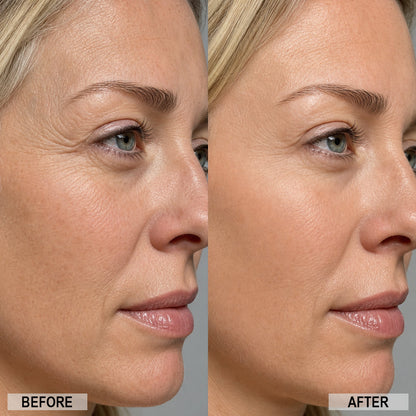 💥100K+ SOLD💕-NESLEMY®Power Redo Wrinkle Fix