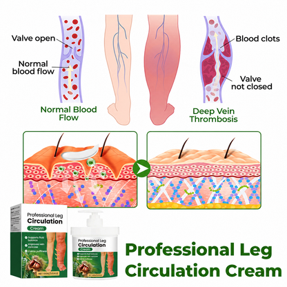 🔥 BUY 1 GET 1 FREE Professional Leg Circulation Cream – Soothe Swelling & Heavy Legs 🦵