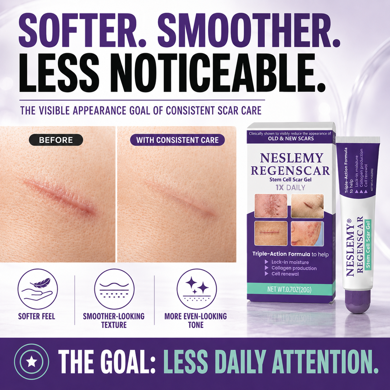 🌟 BUY 1 GET 1 FREE-NESLEMY® Scar Gel ✨ Refresh Your Skin Today!