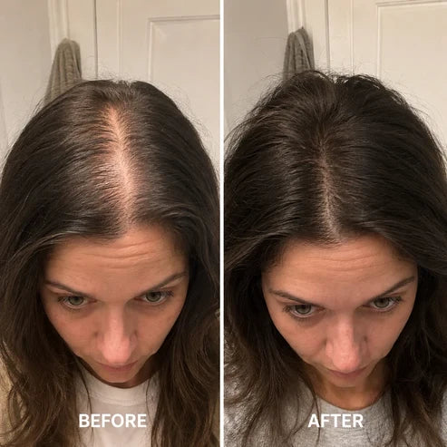 ✨BUY 1 GET 1 FREE✨  Deoxyribose Roll-On Serum for Fuller, Stronger Hair