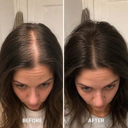 ✨BUY 1 GET 1 FREE✨  Deoxyribose Roll-On Serum for Fuller, Stronger Hair