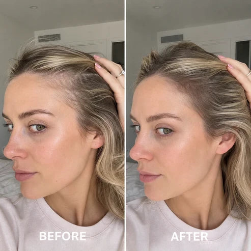 ✨BUY 1 GET 1 FREE✨  Deoxyribose Roll-On Serum for Fuller, Stronger Hair