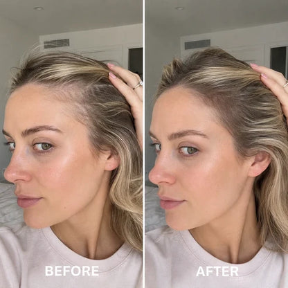 ✨BUY 1 GET 1 FREE✨  Deoxyribose Roll-On Serum for Fuller, Stronger Hair
