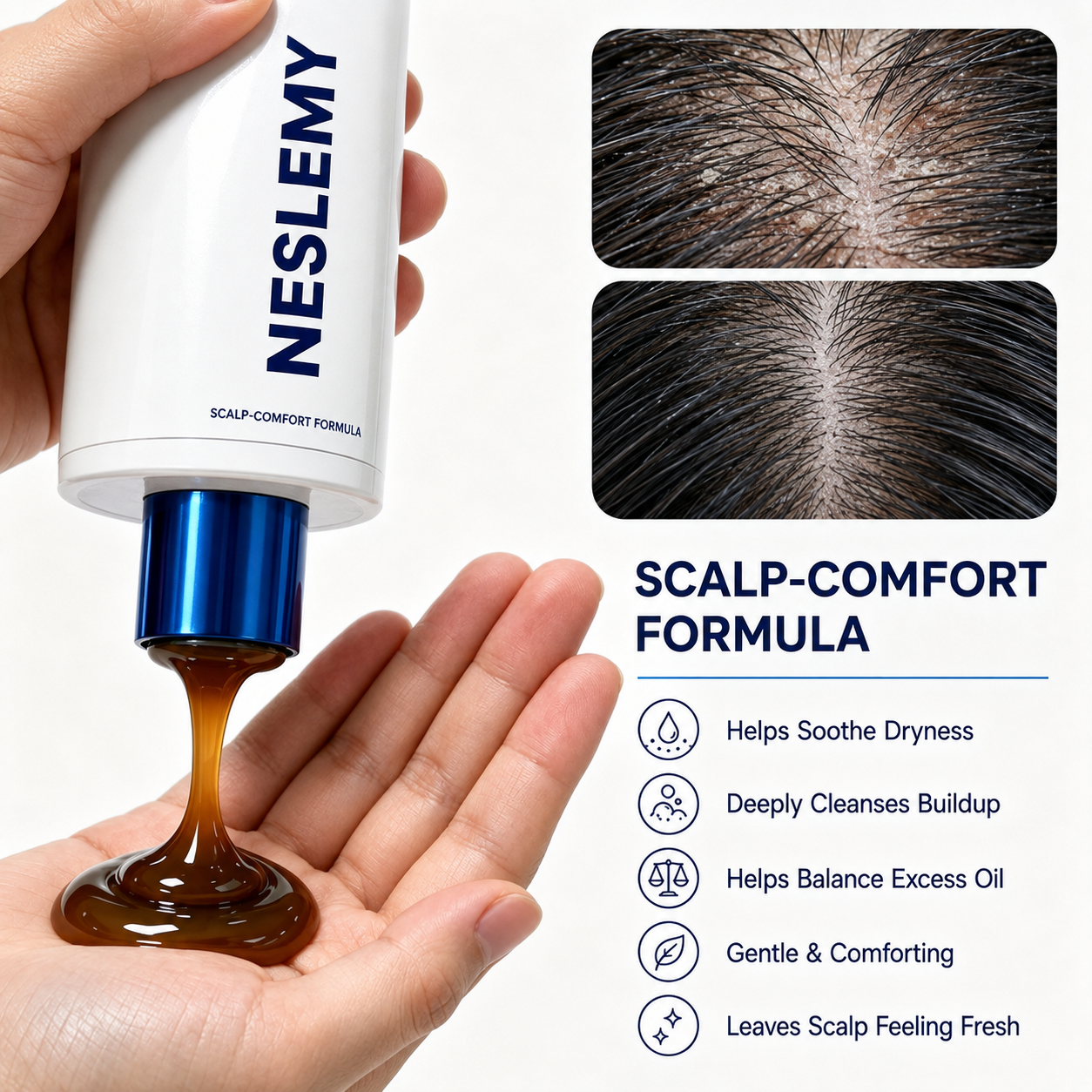 ✨BUY 1 GET 1 FREE✨ NESLEMY  Folliculitis Shampoo for Itchy, Flaky & Oily Scalp!