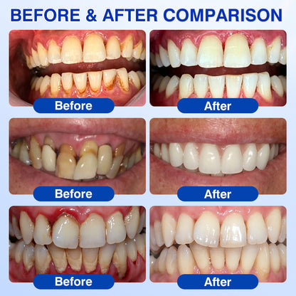 Buy 1 Get 1 Free🦷Periodontal Repair Gel