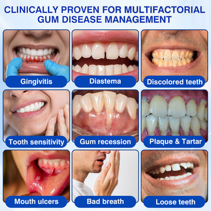 Buy 1 Get 1 Free🦷Periodontal Repair Gel