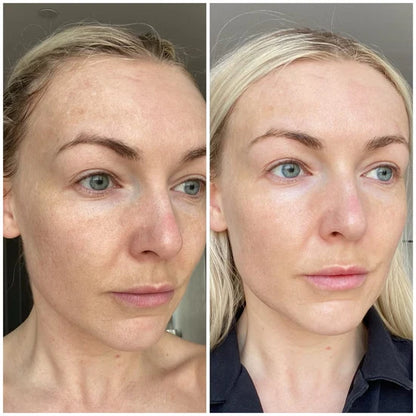Last day Buy 1 Get 1 Free ✨Cougex Silk Peptide EGF Firming Toner