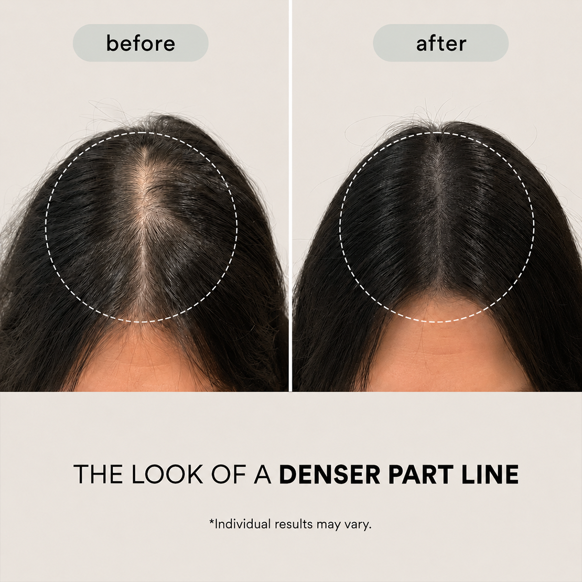 Buy 1 Get 1 Free🌿PDRN HAIR CARE BRUSH HAIR SERUM