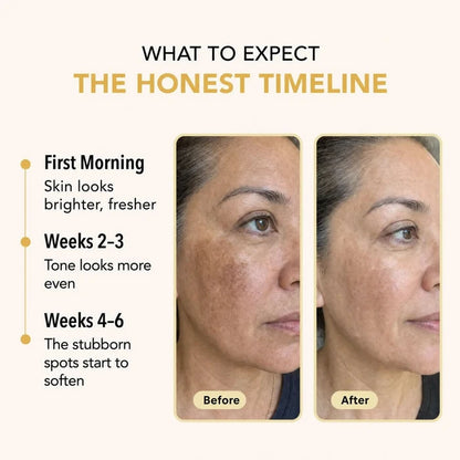 Buy 1 Get 1 Free✨Cougex  Kojic Acid Turmeric Overnight Mask
