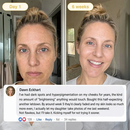 Buy 1 Get 1 Free✨Cougex  Kojic Acid Turmeric Overnight Mask