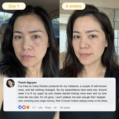 Buy 1 Get 1 Free✨Cougex  Kojic Acid Turmeric Overnight Mask