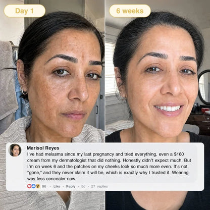 Buy 1 Get 1 Free✨Cougex  Kojic Acid Turmeric Overnight Mask