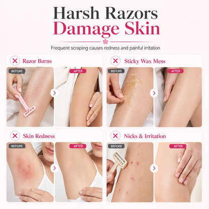 Gentle Smooth Roll-On Hair Removal product image 2